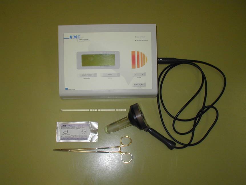 Ošetření metodou ultrazvukem kontrolovaného podvazu hemoroidální tepny (DG HAL metoda)